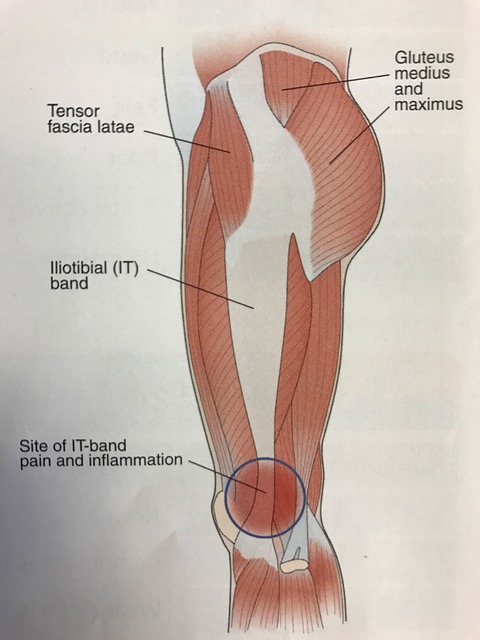 Do You Have Unexplained Knee Pain? Maybe You Have ITBS! by Kristin  Eannotti, M.S.